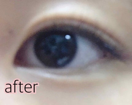 アイテープ(絆創膏タイプ、レギュラー、70枚)/DAISO/二重まぶた用アイテムを使ったクチコミ(3枚目)