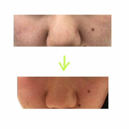 ゆうり on LIPS 「こんにちはゆうりです🌼私なりに1ヶ月弱色々研究してみましたので..」(4枚目)