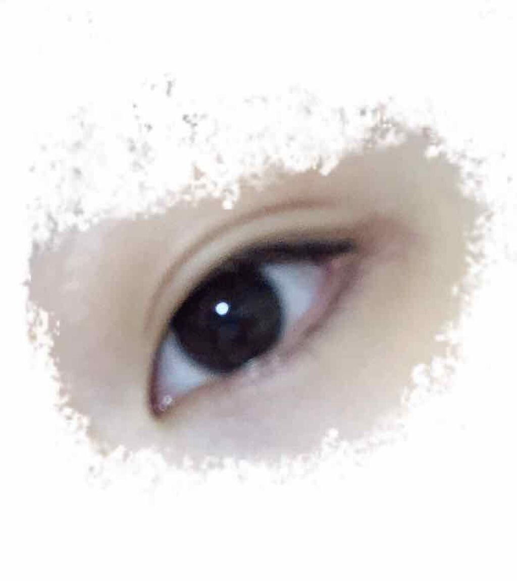 くろず on LIPS 「mediaで腫れてしまったときの画像が出てきました…!(閲覧注..」(2枚目)