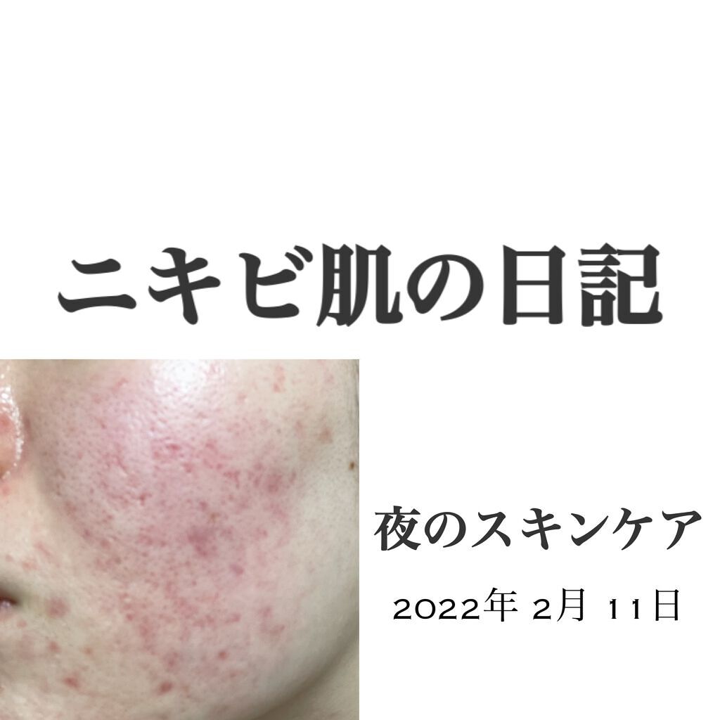 マイルドクレンジング オイル/ファンケル/オイルクレンジングを使ったクチコミ(1枚目)