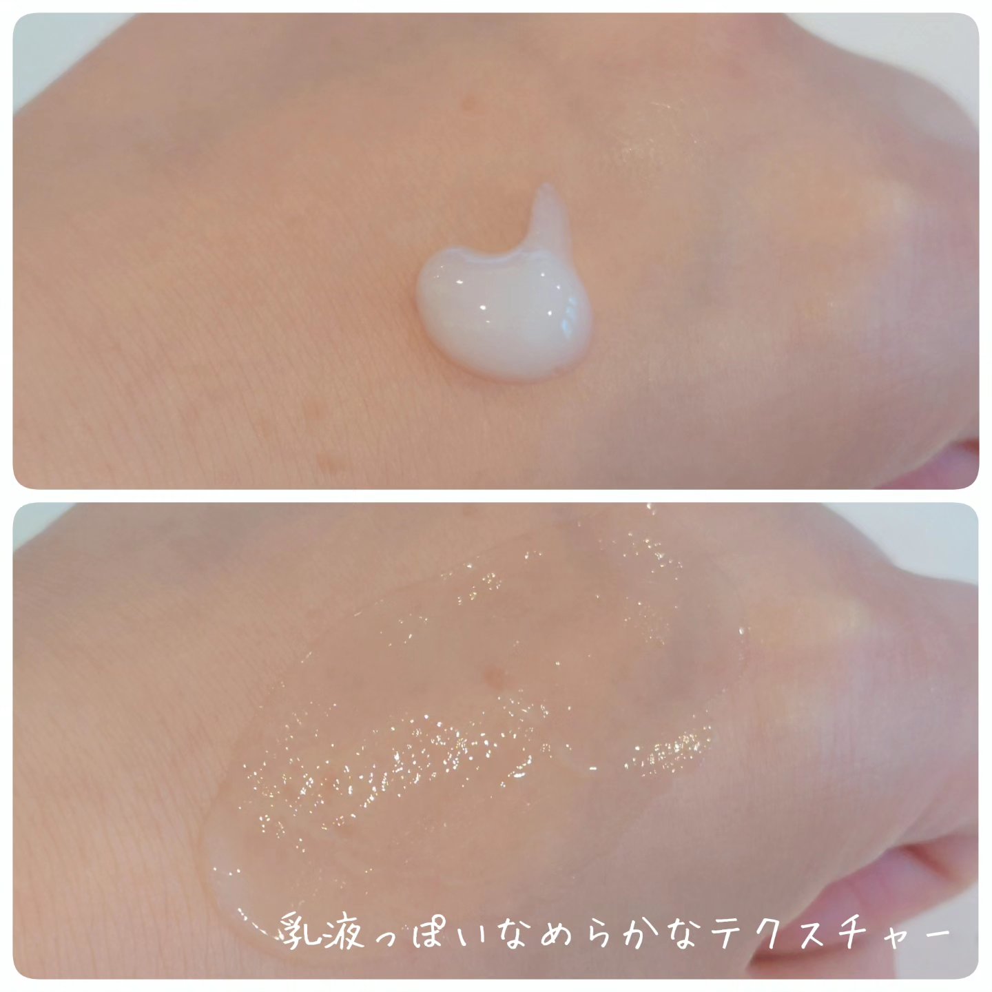 ビディ ニードルエッセンス GG/ビディ/美容液を使ったクチコミ（3枚目）