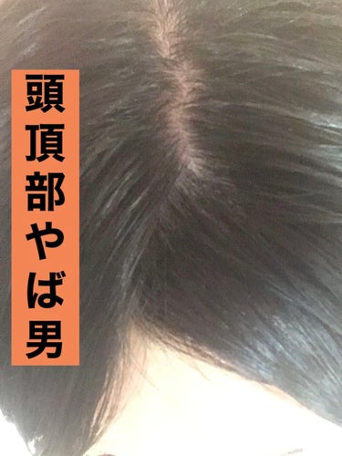 ミノン薬用ヘアシャンプー／薬用コンディショナー/ミノン/シャンプー・コンディショナーを使ったクチコミ（1枚目）