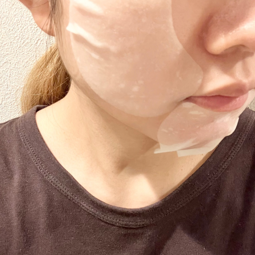 センテラ クイックカーミングパッド/SKIN1004/トナーパッドを使ったクチコミ（3枚目）