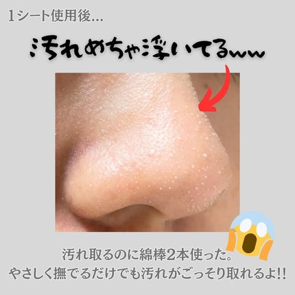 ナチュラルマイルドクリアノーズパック/ilso/シートマスク・パックを使ったクチコミ(4枚目)