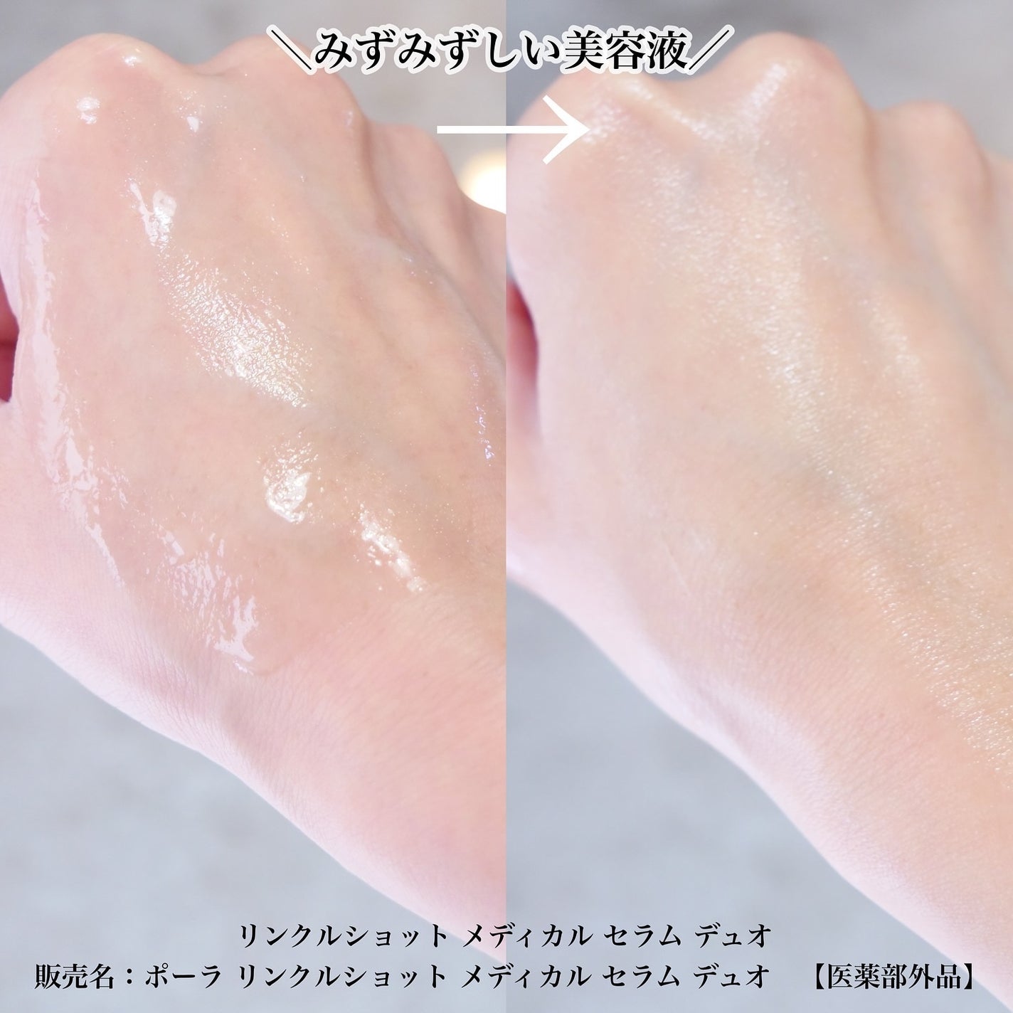 ポーラ リンクルショット メディカル セラム デュオ/リンクルショット/美容液を使ったクチコミ(4枚目)