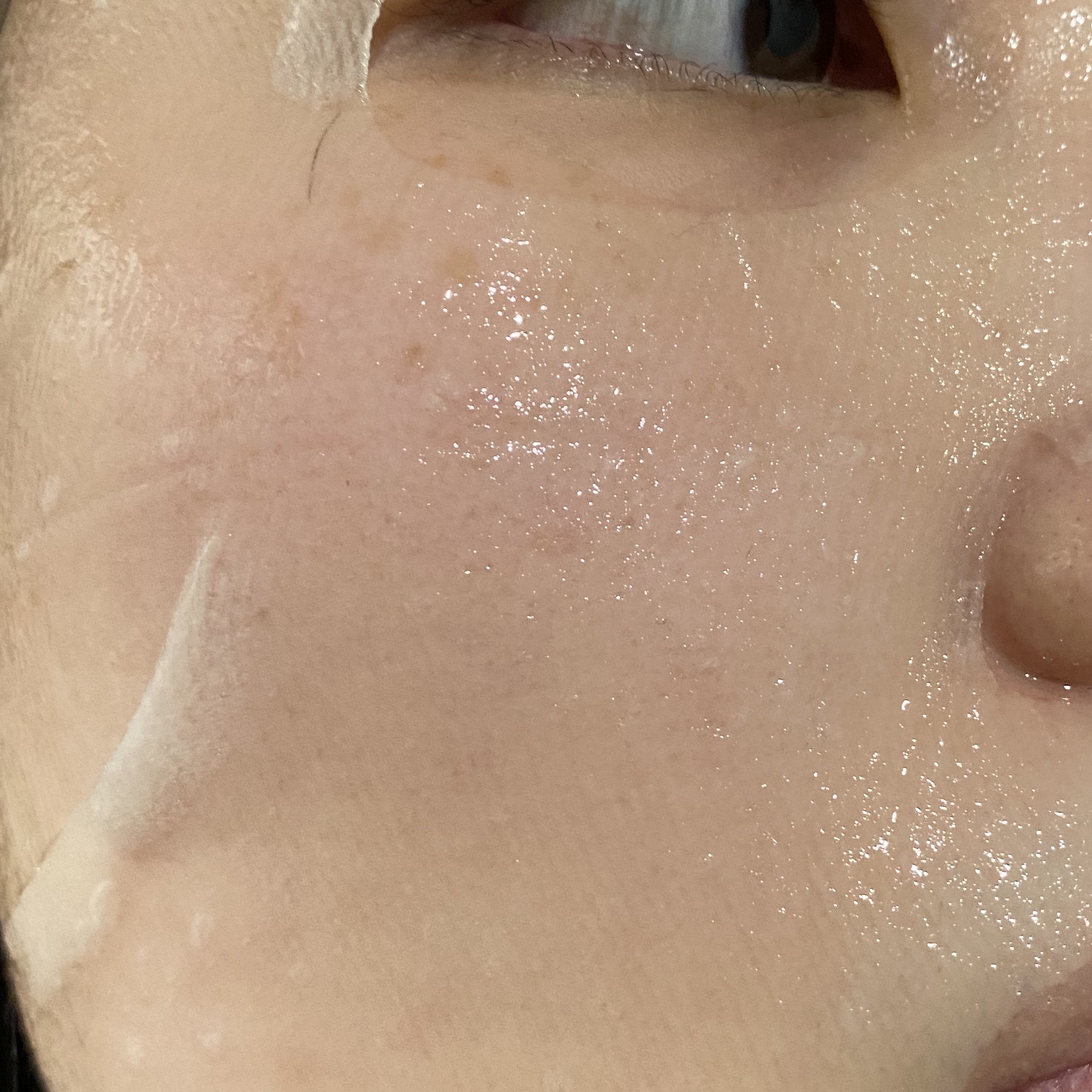 CICAシートマスク/DCURE+/シートマスク・パックを使ったクチコミ（3枚目）