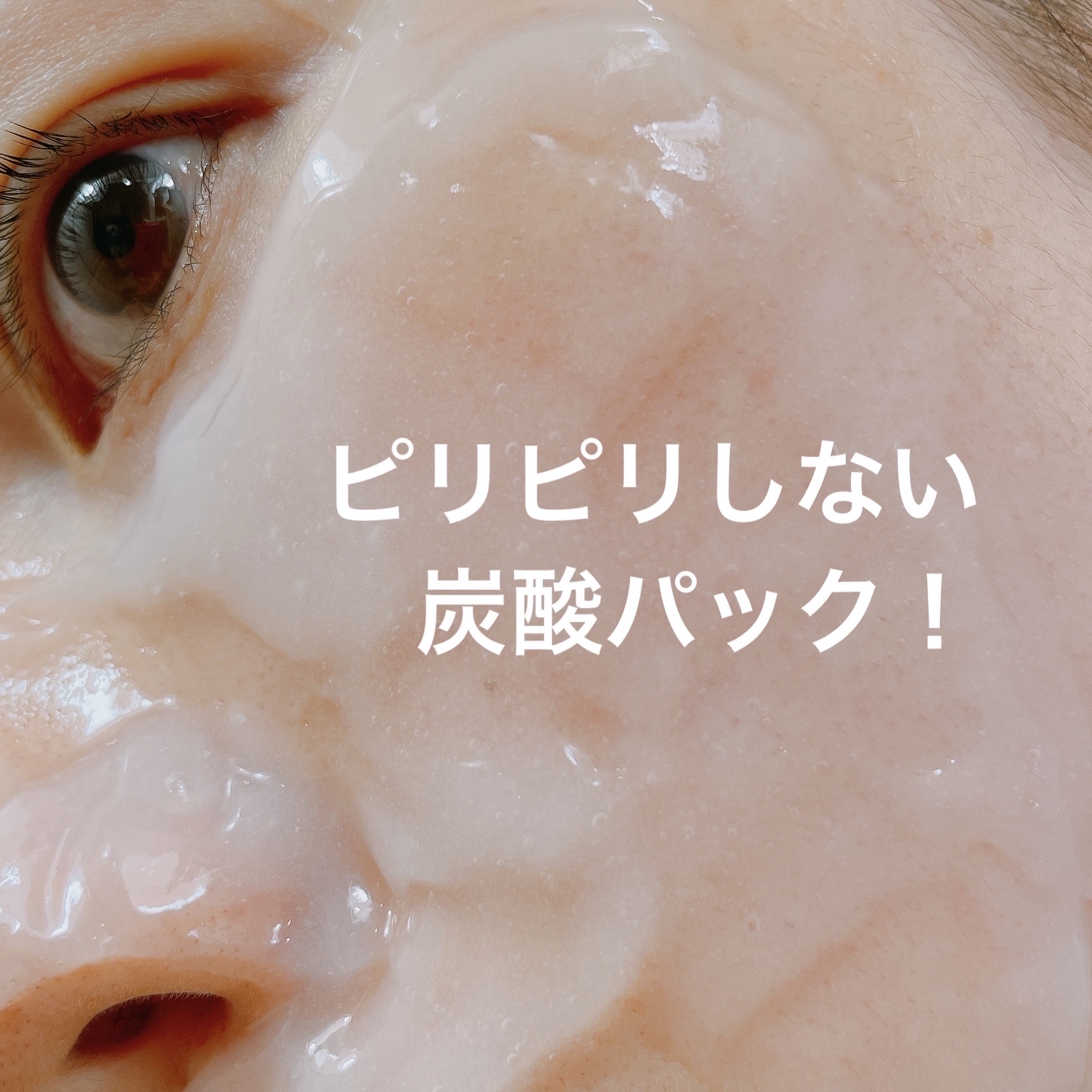 モイストリッチ炭酸パック/セルロジーコスメ/シートマスク・パックを使ったクチコミ（1枚目）