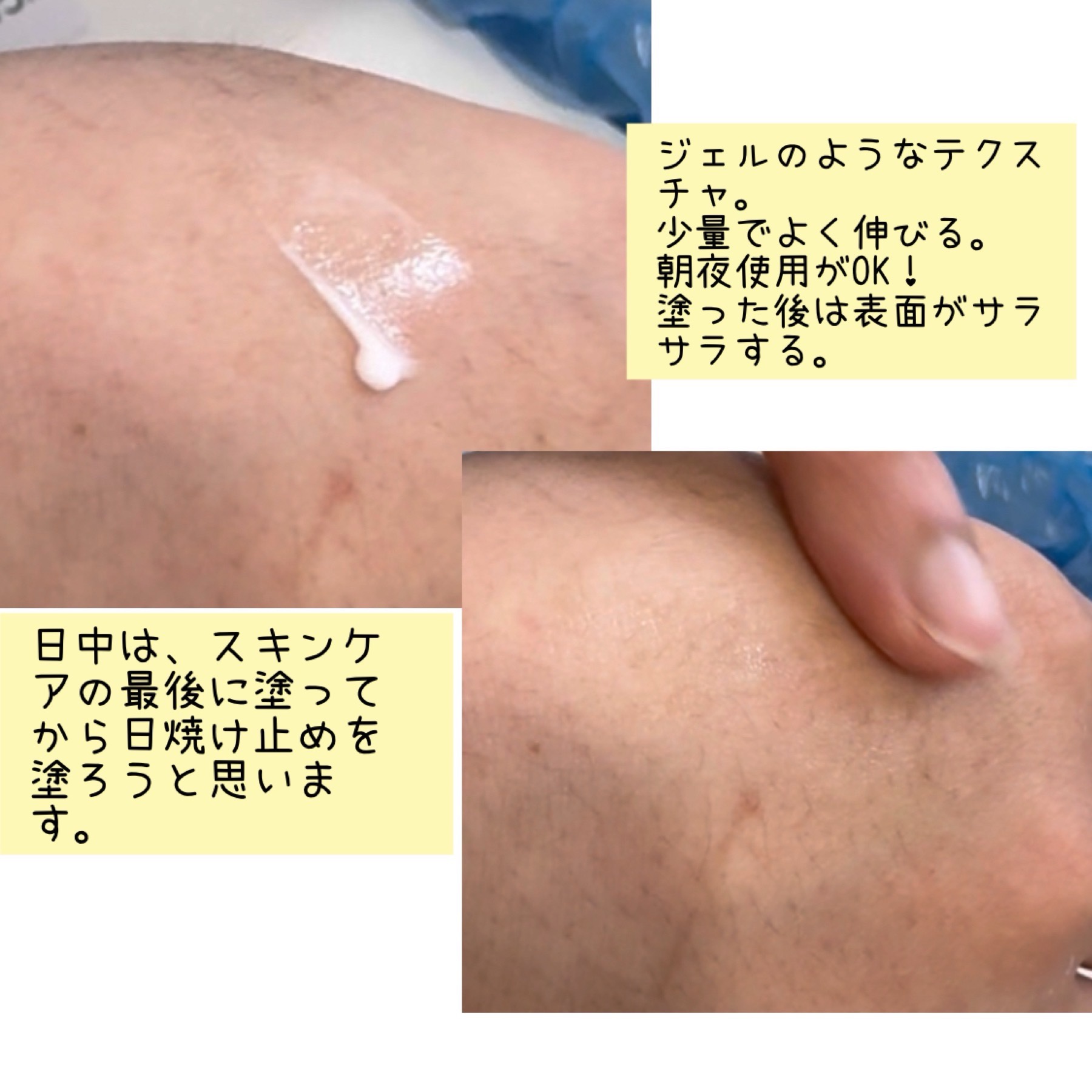 HiCA　AZAリペアクリーム アゼライン酸10%/HiCA/フェイスクリームを使ったクチコミ（3枚目）