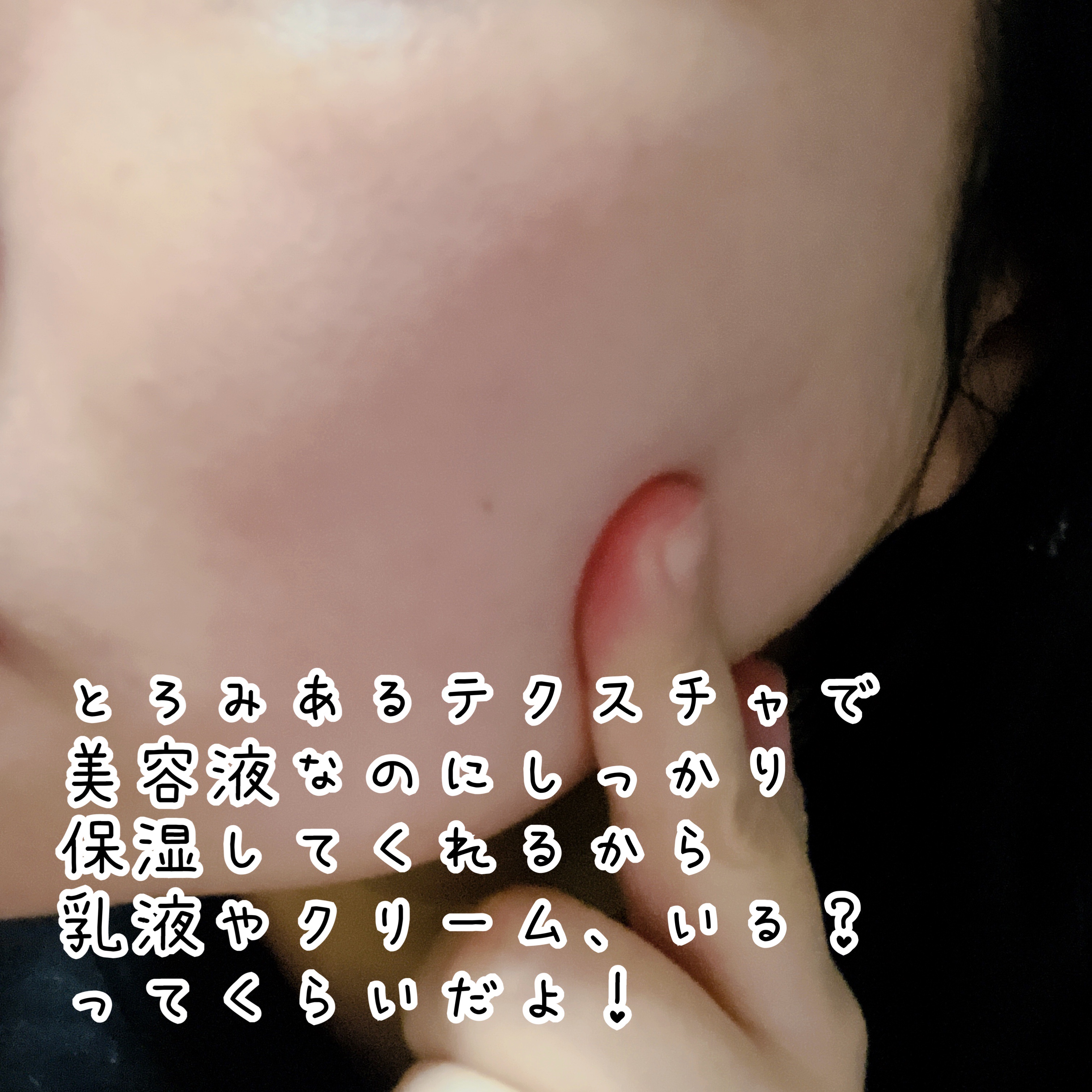 プロバイオシカ インテンシブ アンプル/SKIN1004/美容液を使ったクチコミ（3枚目）