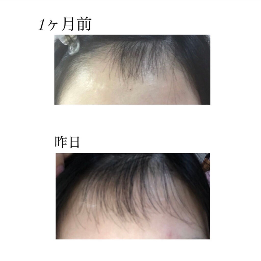 ヘアアクセルレーター フローラルの香り 加美乃素本舗の使い方を徹底解説 髪の毛を早く伸ばしたい そんなあなたへおすすめの商品です By もも 乾燥肌 10代後半 Lips ヘアアクセルレーター フローラルの香り 加美乃素本舗の使い方を徹底解説 髪の毛を早く伸ばしたい そんなあなたへおすすめの商品です By もも 乾燥肌 10代後半 Lips