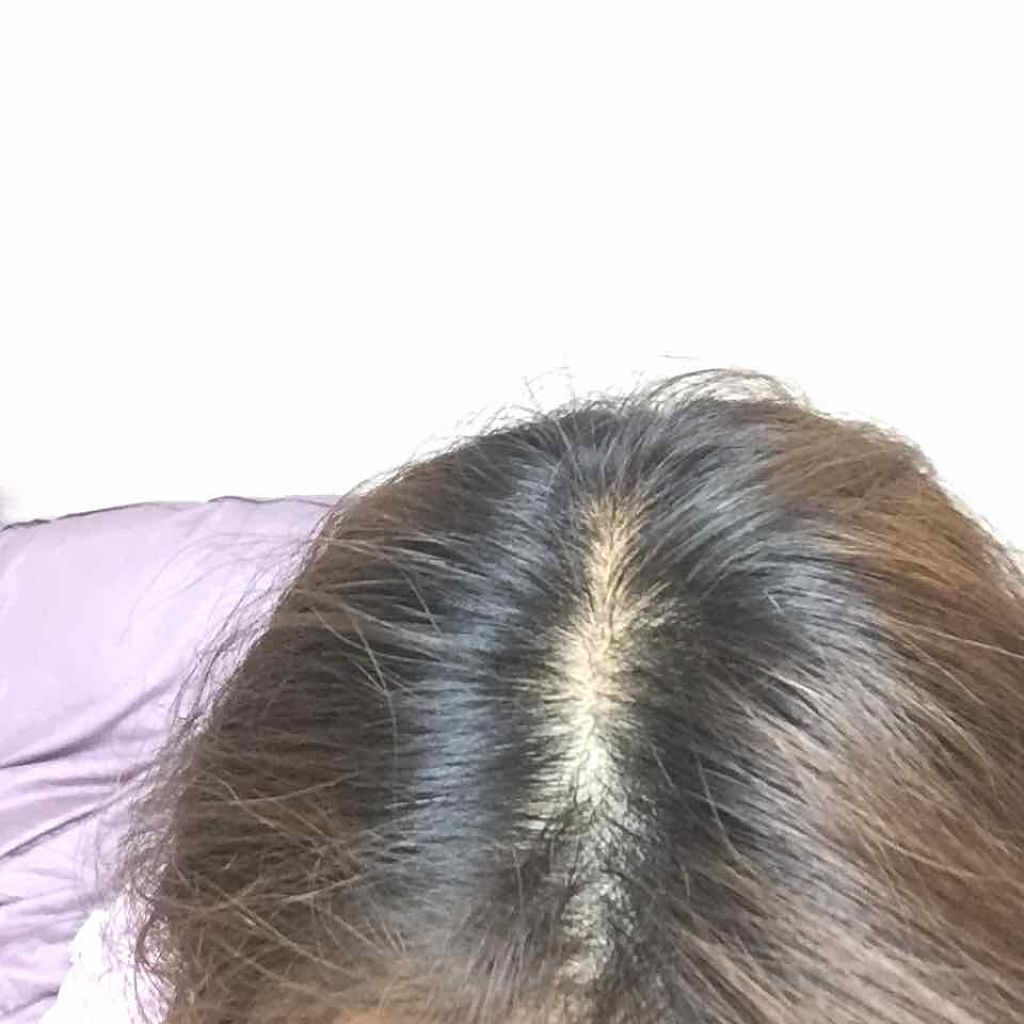 泡カラー/リーゼ/ヘアカラーを使ったクチコミ(2枚目)