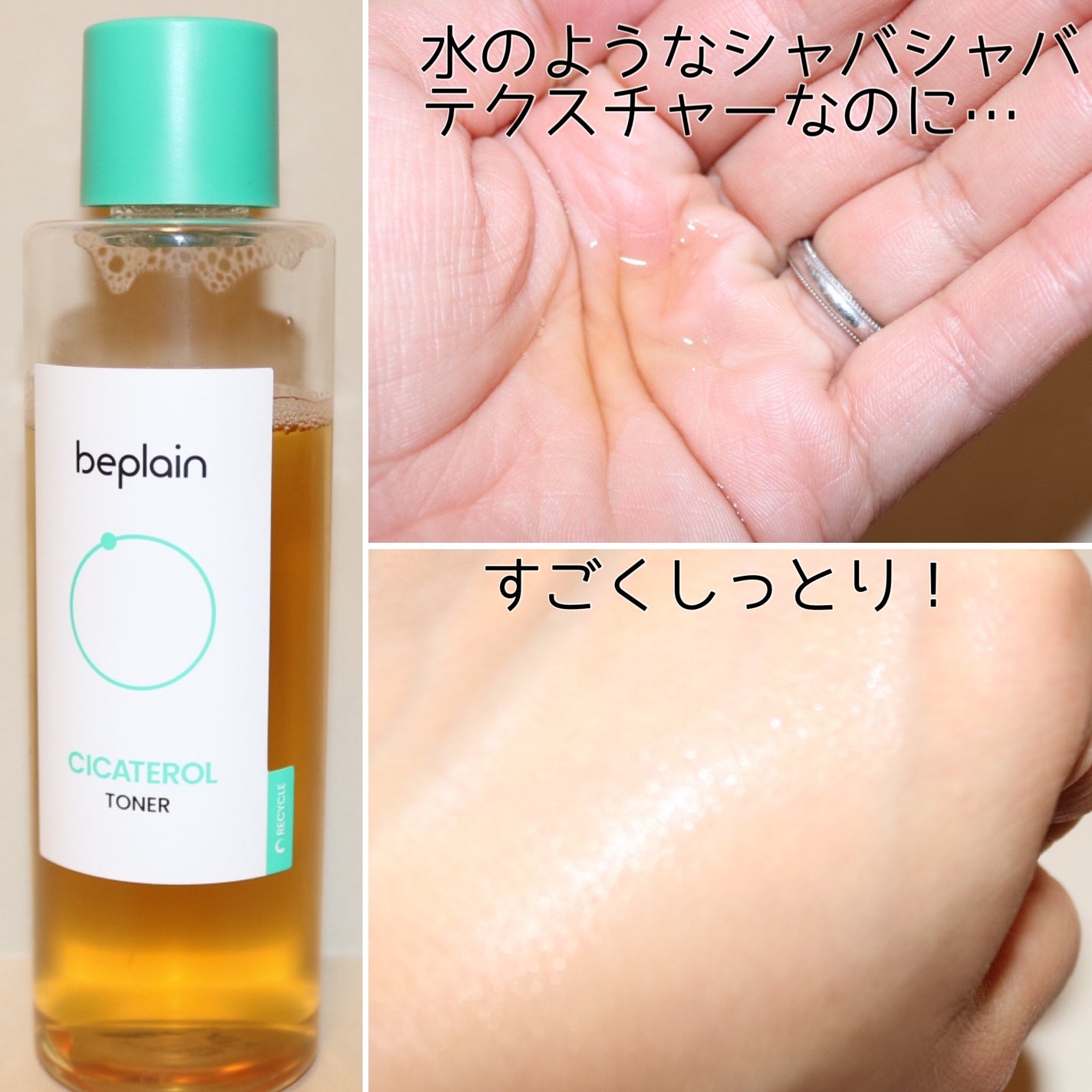 シカテロルトナー/beplain/化粧水を使ったクチコミ(3枚目)