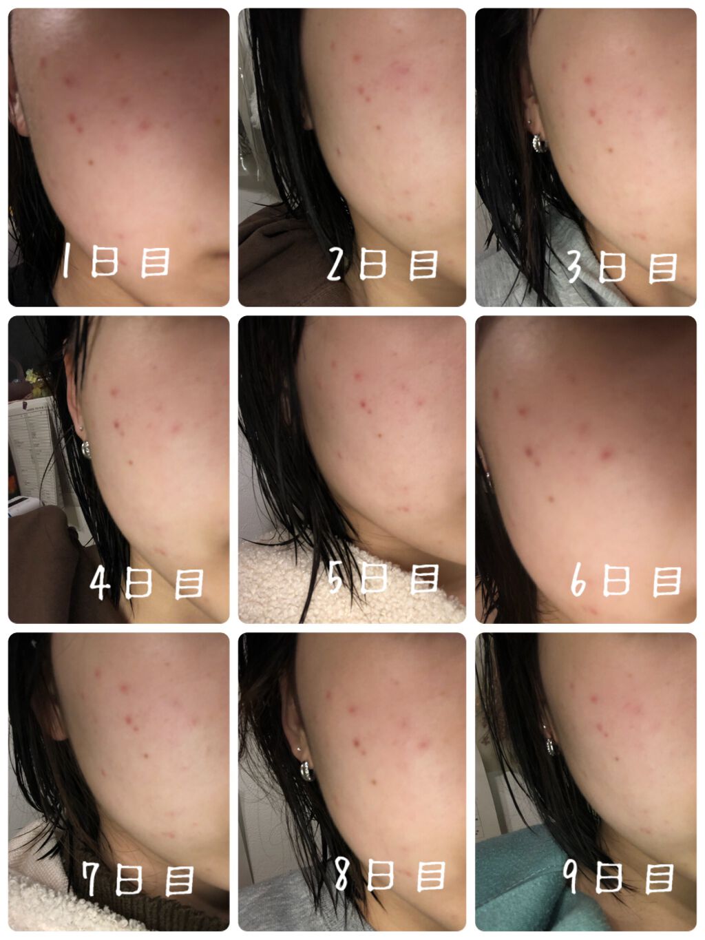 薬用 雪肌精 乳液/雪肌精/乳液を使ったクチコミ（2枚目）