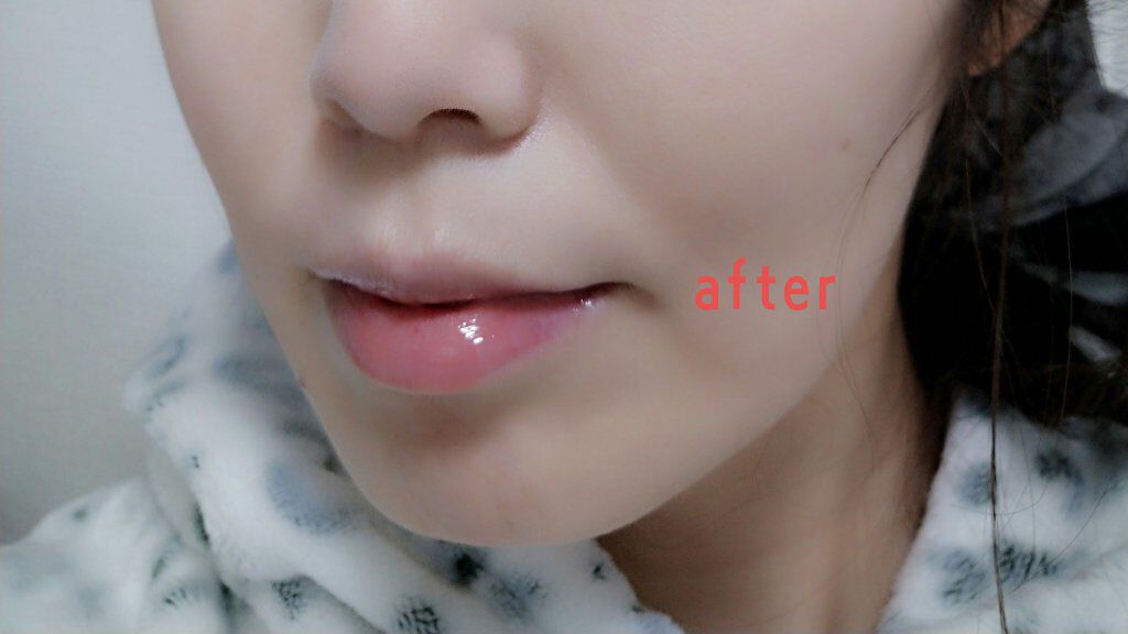 ボリュームアップレディグロス/キャンメイク/リップグロスを使ったクチコミ（3枚目）