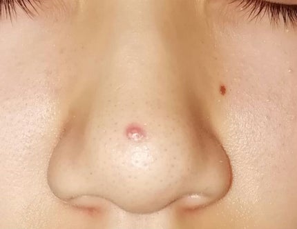 極潤 ヒアルロン液 ライトタイプ/肌ラボ/化粧水を使ったクチコミ(3枚目)