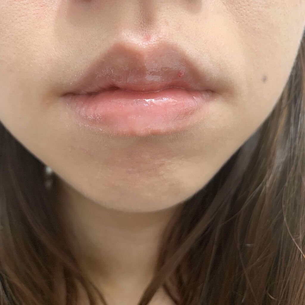 リップフォンデュ/メンソレータム/リップバームを使ったクチコミ(3枚目)