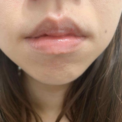 リップフォンデュ/メンソレータム/リップバームを使ったクチコミ(3枚目)