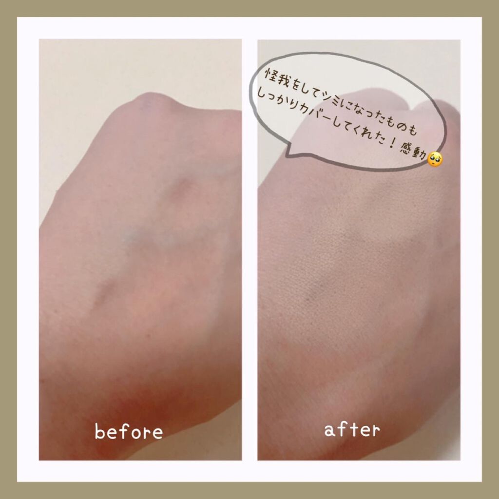 スポッツカバー ファウンデイション/SHISEIDO/クリームコンシーラーを使ったクチコミ(2枚目)