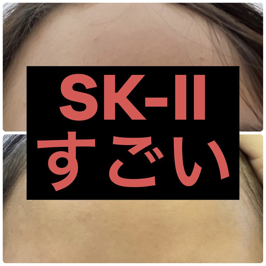 フェイシャル トリートメント エッセンス/SK-II/化粧水を使ったクチコミ（1枚目）
