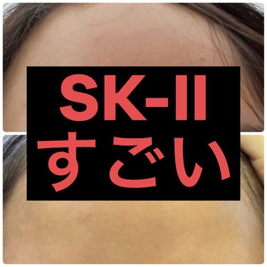 フェイシャル トリートメント エッセンス/SK-II/化粧水を使ったクチコミ（1枚目）