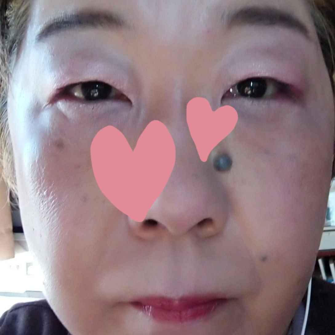 クリスマスコレクション/Ririmew/メイクアップキットを使ったクチコミ（3枚目）