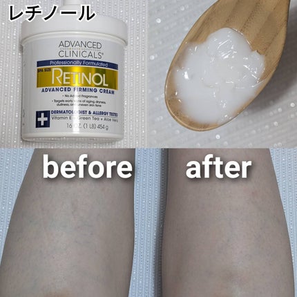 レチノールセラム/ADVANCED CLINICALS/美容液を使ったクチコミ(4枚目)