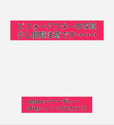 DHC ビタミンＣハードカプセル/DHC/美容サプリメントを使ったクチコミ（2枚目）