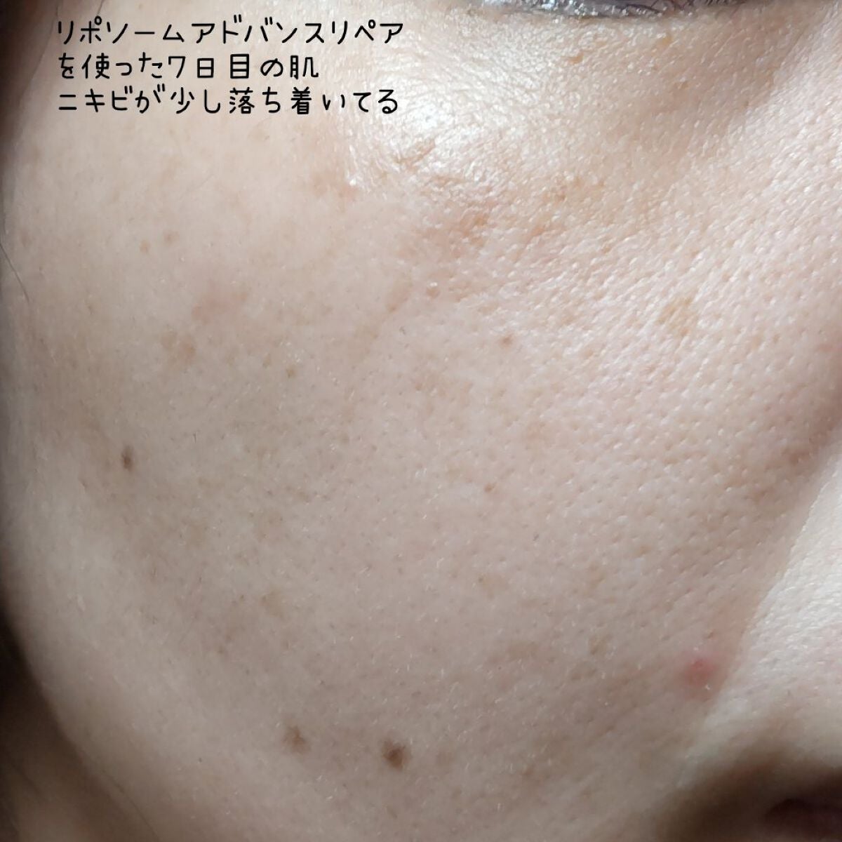 リポソーム アドバンスト リペアセラム/DECORTÉ/美容液を使ったクチコミ(9枚目)