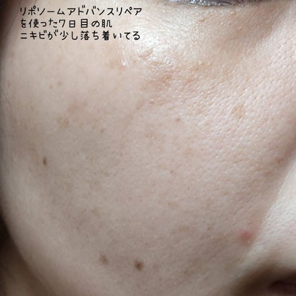 リポソーム アドバンスト リペアセラム/DECORTÉ/美容液を使ったクチコミ(9枚目)