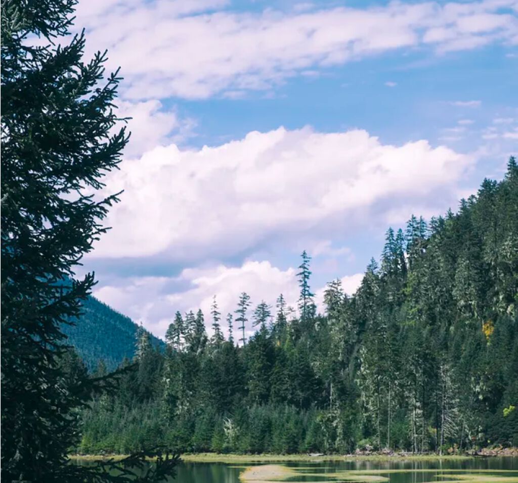 shinasaka 脱毛器 光美容器/shinasaka/家庭用脱毛器を使ったクチコミ（3枚目）