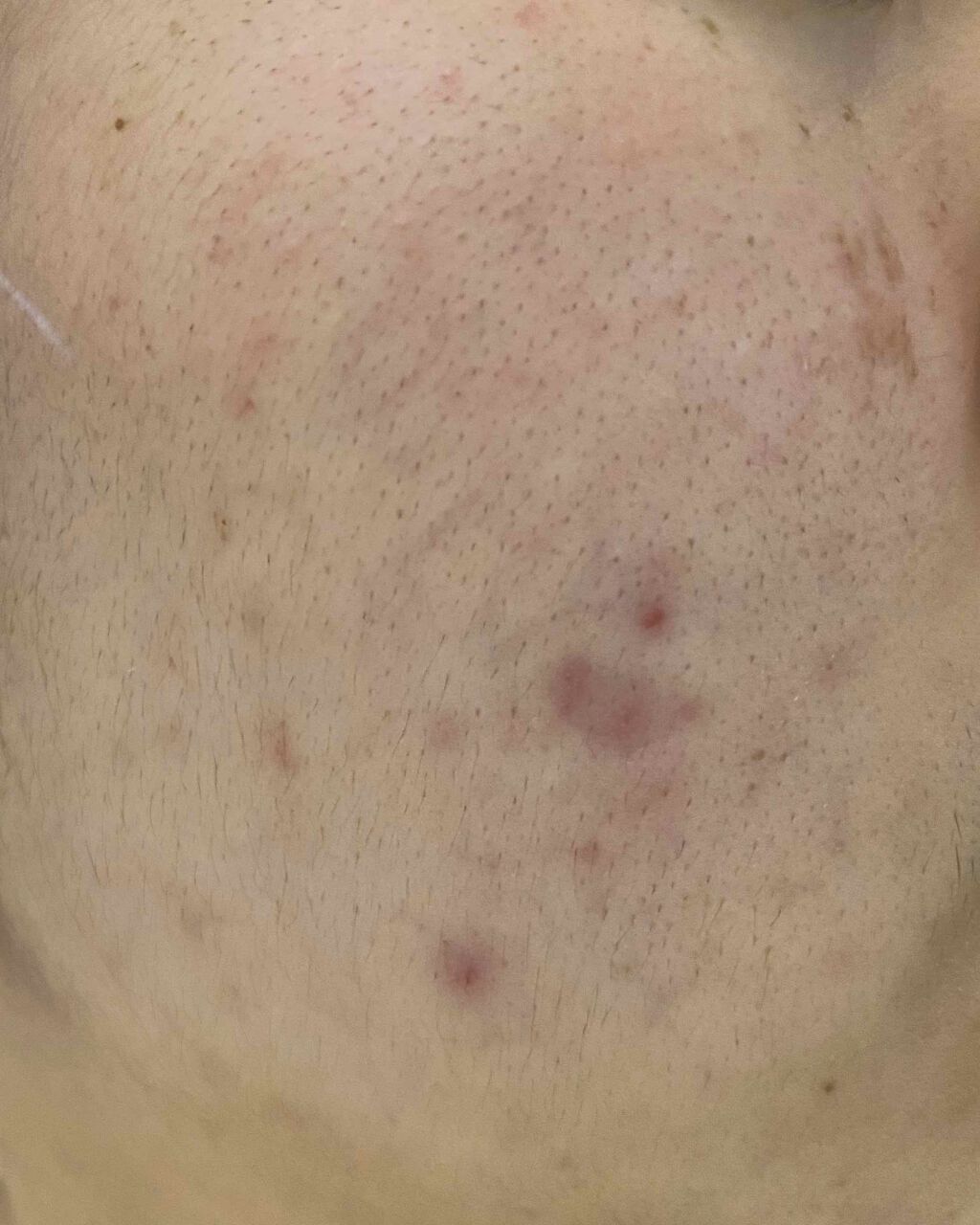 敏感肌用薬用美白美容液/無印良品/美容液を使ったクチコミ（2枚目）