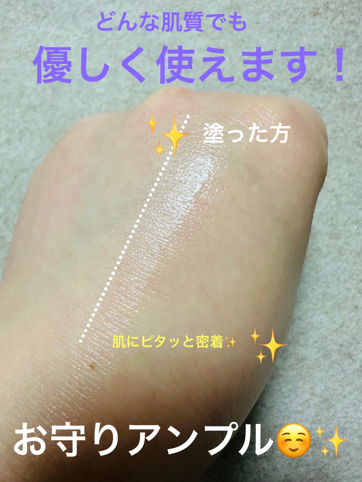 シカテロル美容液/beplain/美容液を使ったクチコミ(4枚目)