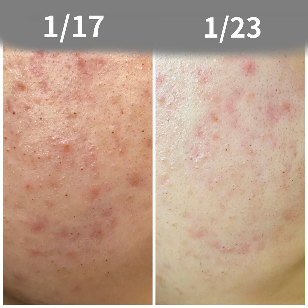 クレンジングバーム モイスト/CLAYGE/クレンジングバームを使ったクチコミ(1枚目)