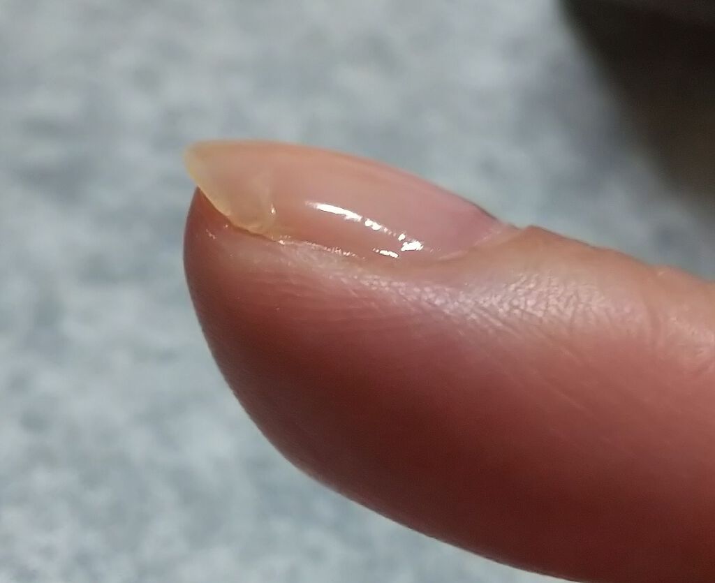 スプリットリペアN/ネイルネイル/ネイルオイル・トリートメントを使ったクチコミ（1枚目）