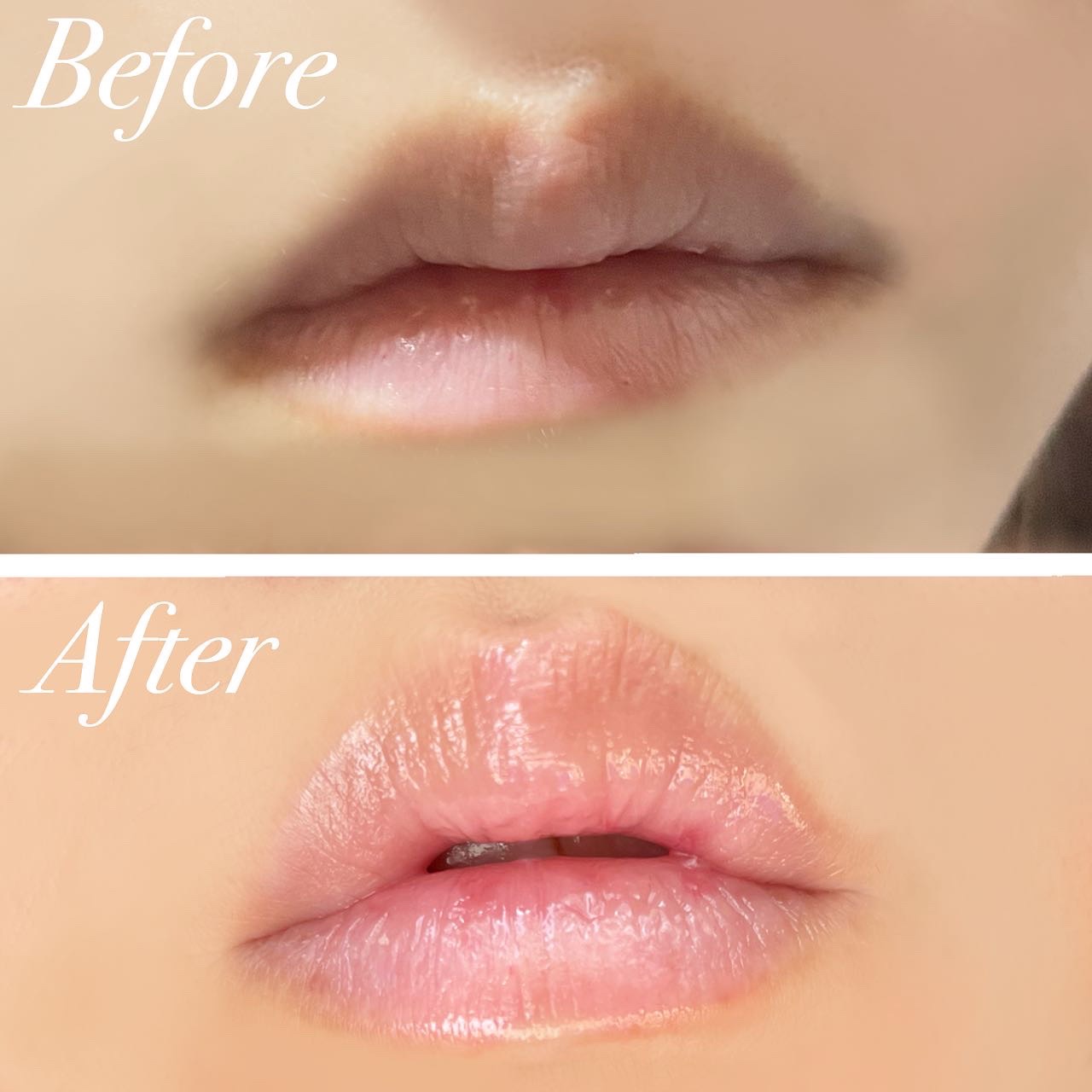 イリュン コラーゲンモイスチャーリップマスク/illuN/リップマスクを使ったクチコミ（2枚目）