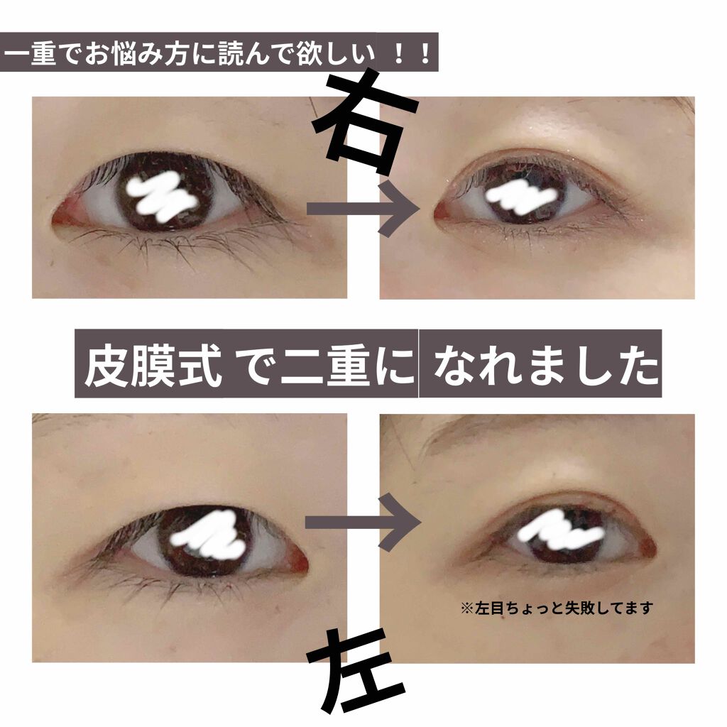 アイトーク スーパーホールド/アイトーク/二重まぶた用アイテムを使ったクチコミ(1枚目)