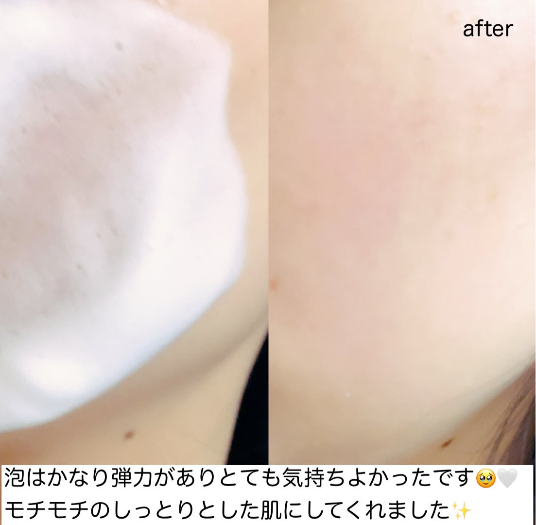 グリーントマトクリーム/FULLY/フェイスクリームを使ったクチコミ(3枚目)