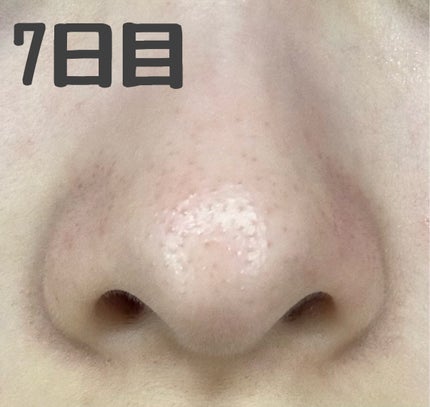 ビタペアC 集中美容液スペシャルセット/ネイチャーリパブリック/美容液を使ったクチコミ(3枚目)