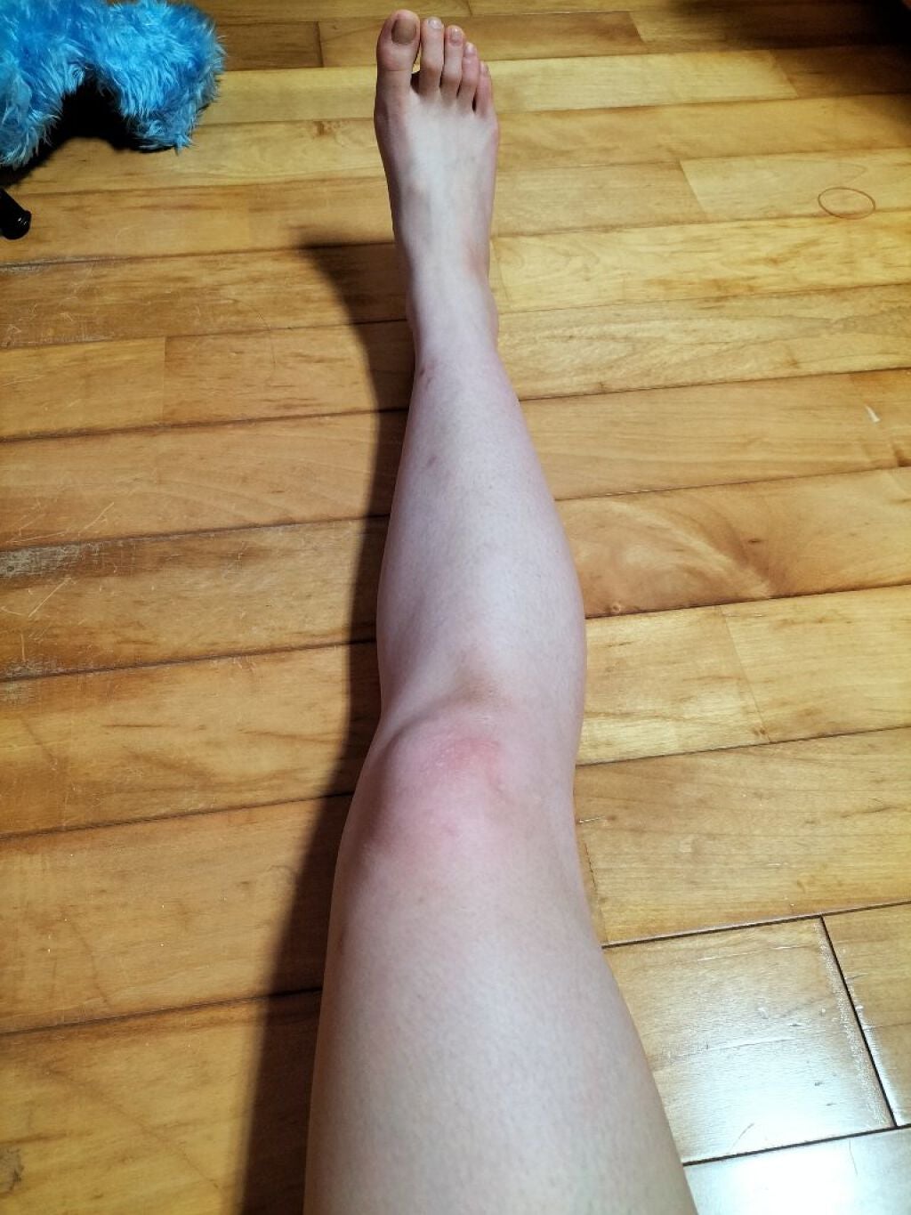 momo ෆ on LIPS 「昨日はひなちゃんねる様の脚やせトレ3日目でしたまだ顕著な変化は..」(2枚目)