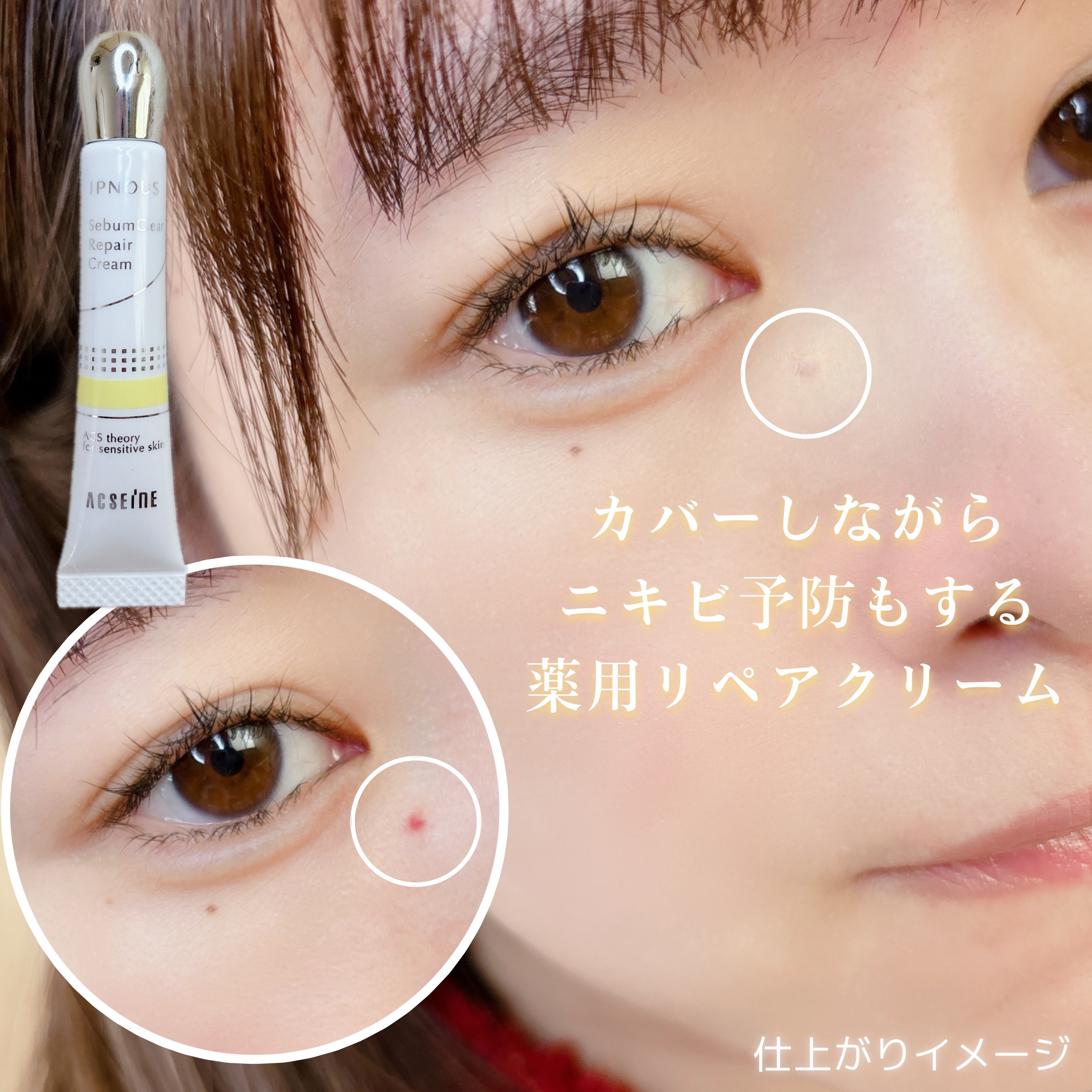 イプノス シーバムクリア リペアクリーム/ACSEINE/フェイスクリームを使ったクチコミ（1枚目）