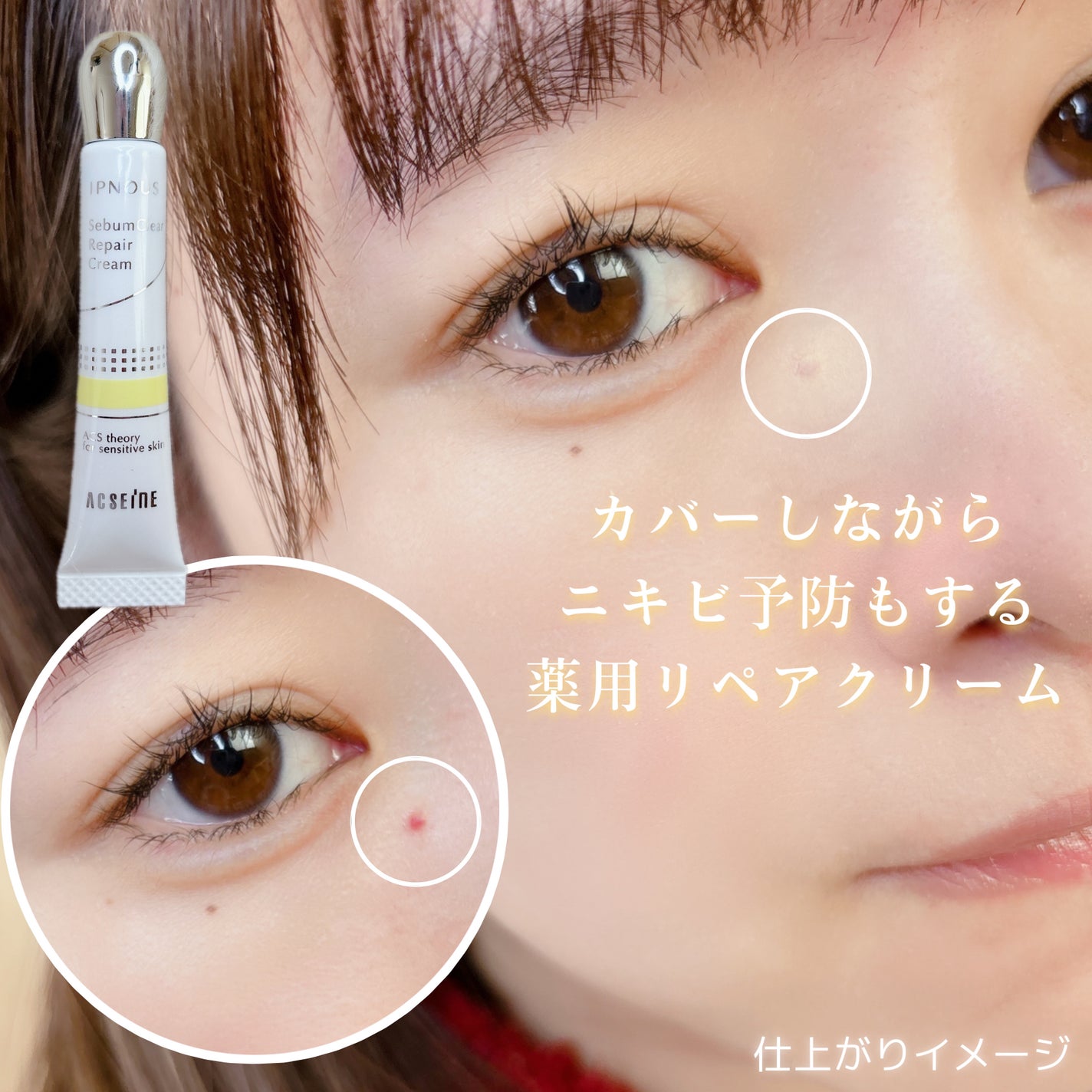 イプノス シーバムクリア リペアクリーム/ACSEINE/フェイスクリームを使ったクチコミ(1枚目)