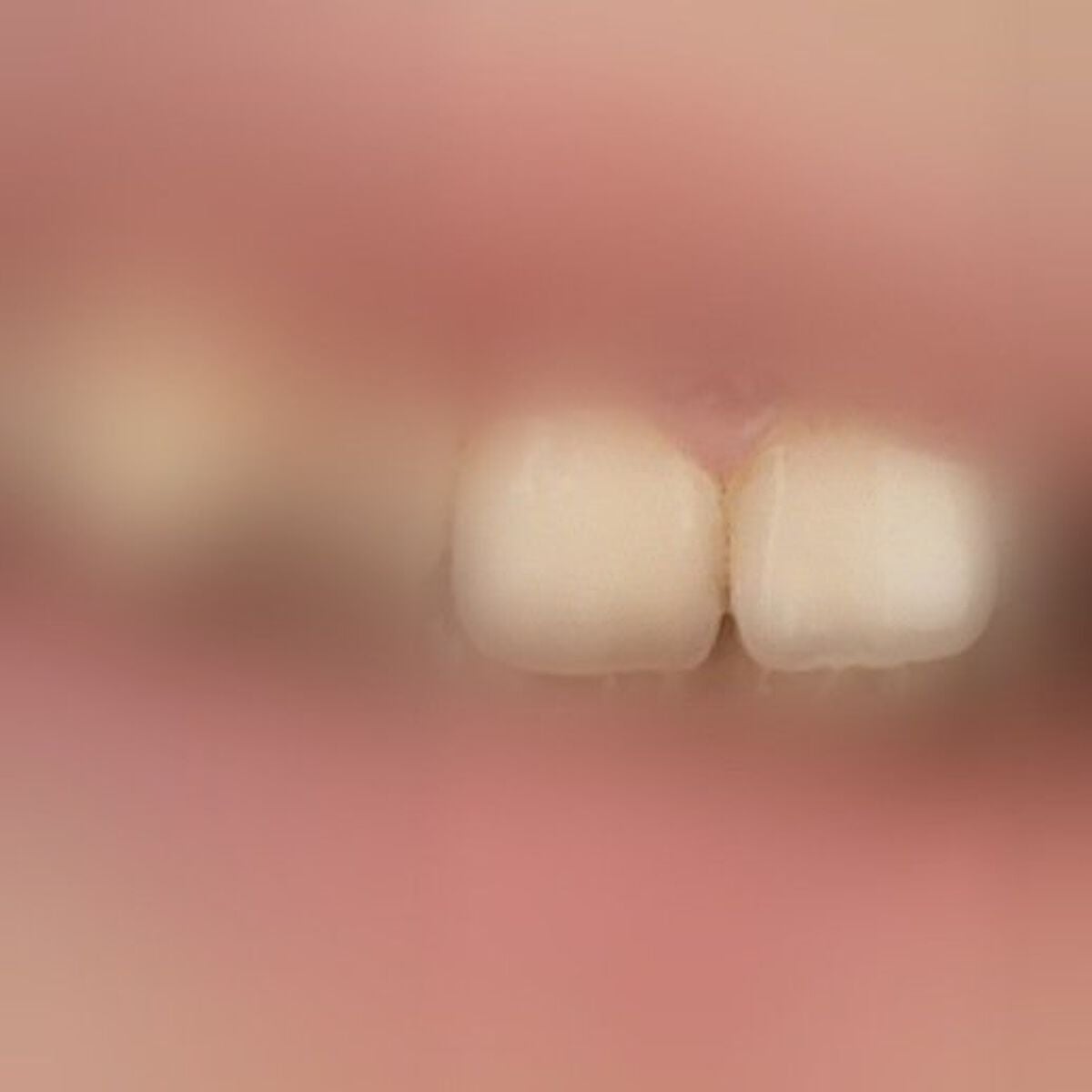 ホワイティエッセンス/MiiS/その他オーラルケアを使ったクチコミ(7枚目)