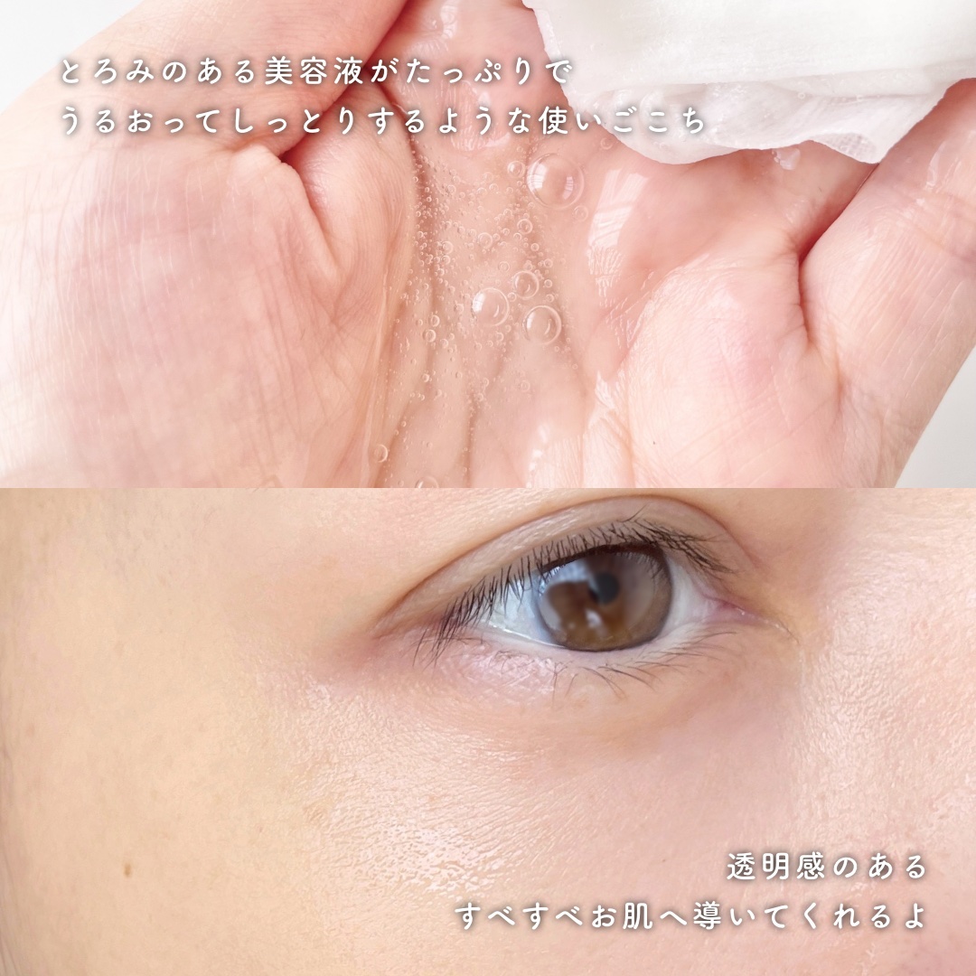 薬用ルルルン 美白アクネ/ルルルン/シートマスク・パックを使ったクチコミ（3枚目）