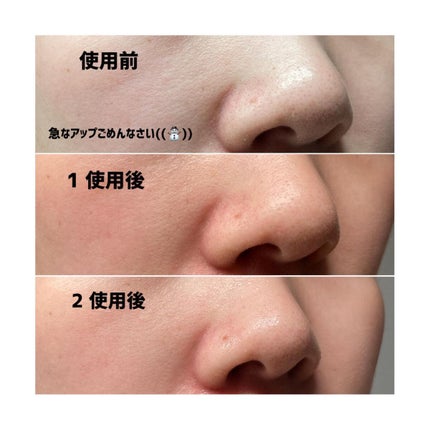 ナチュラルマイルドクリアノーズパック/ilso/シートマスク・パックを使ったクチコミ(8枚目)