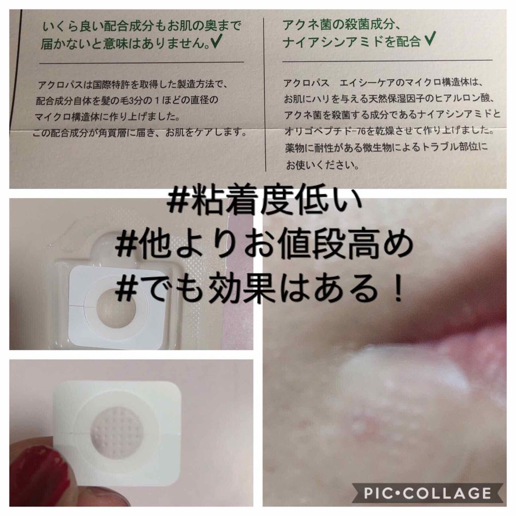 ACケアプラス/ACROPASS/その他キットセットを使ったクチコミ(2枚目)
