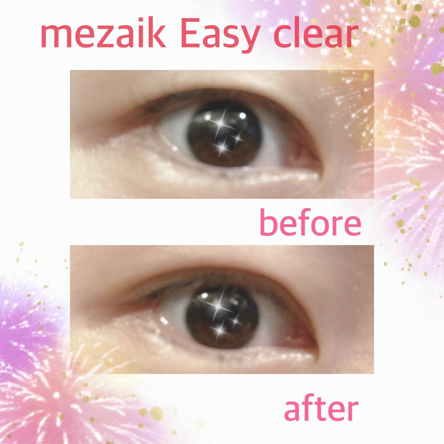 メザイク イージークリア 接着クリアタイプ/メザイク/二重まぶた用アイテムを使ったクチコミ(3枚目)