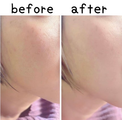 ウォンジョンヨ プロ パーフェクティングクッション ナチュラル/Wonjungyo/クッションファンデーションを使ったクチコミ(8枚目)