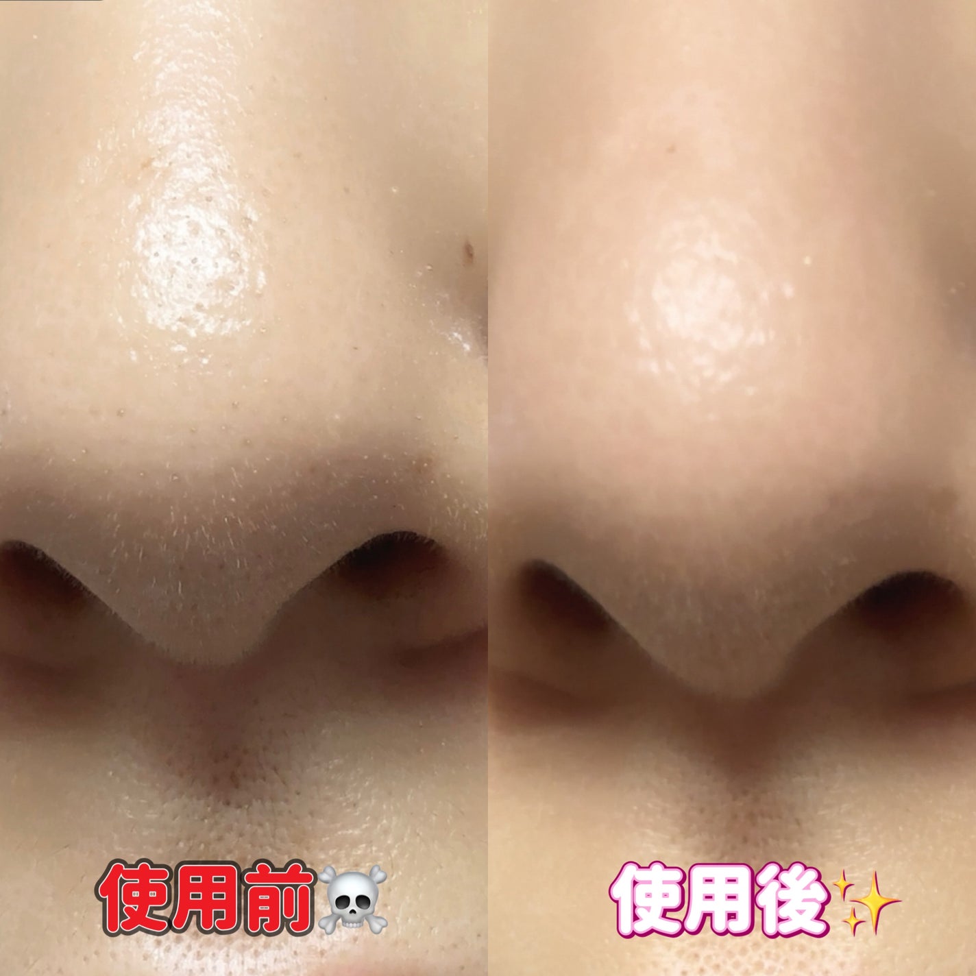 ディズム クリーミーフォームウォッシュ ブラック/DISM/泡洗顔を使ったクチコミ(3枚目)