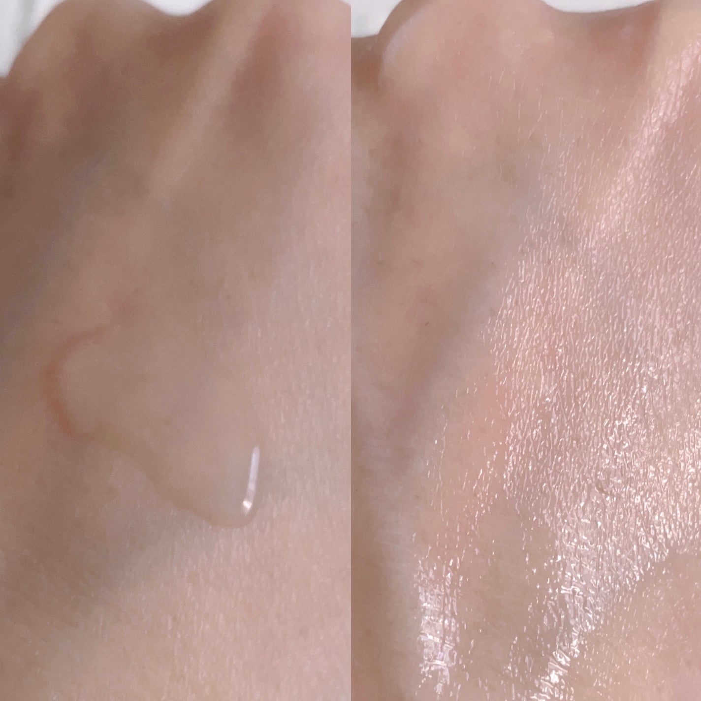 ガラクナイアシン2.0エッセンス/manyo/美容液を使ったクチコミ(3枚目)