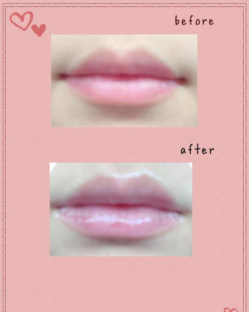 メルティクリームリップ/メンソレータム/リップクリームを使ったクチコミ（3枚目）